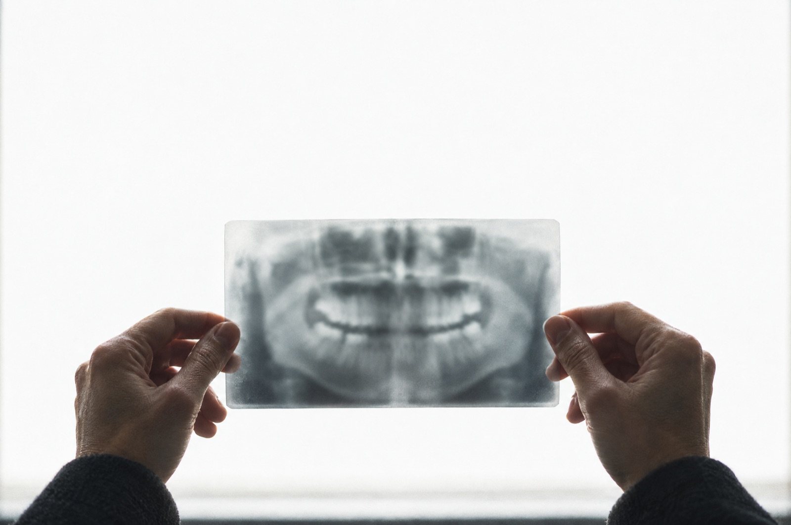Radiografia panorâmica examinada contra a luz antes do planejamento cirúrgico